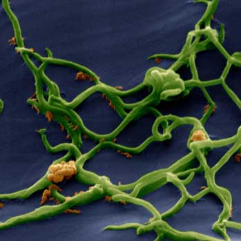 Borrelia Burgdorferi - Version 2.5