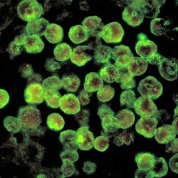 Naegleria Fowleri - Version 2.0