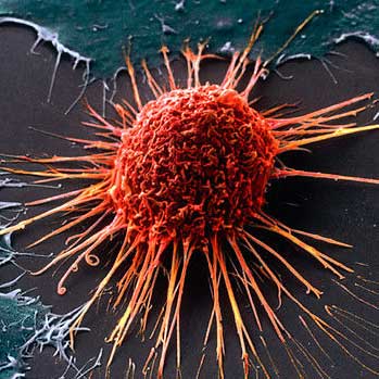 Cancer Cell Metabolism - Version 3.0
