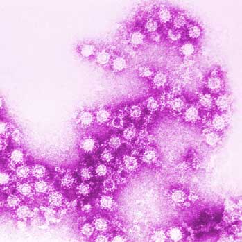 Cocksacki B4 Virus - Version 4.0