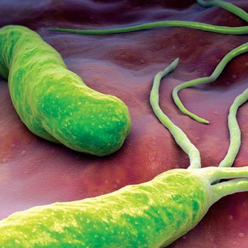 Helicobacter Pylori - Version 2.5