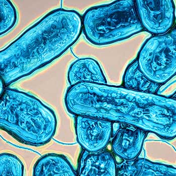 Legionaire's Disease - Version 1.0