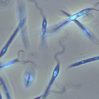 Leischmania Mexicana - Version 1.2