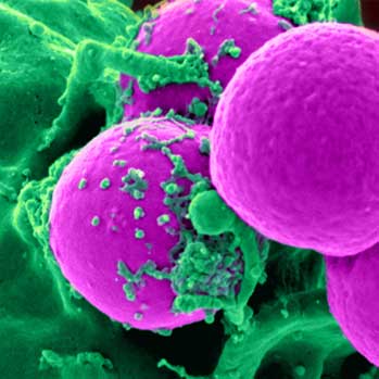 MRSA Killer Bacteria - Version 3.1