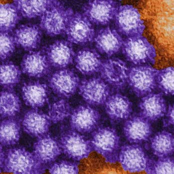 Norovirus - Version 2.1