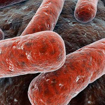 Tuberculosis - Version 4.2