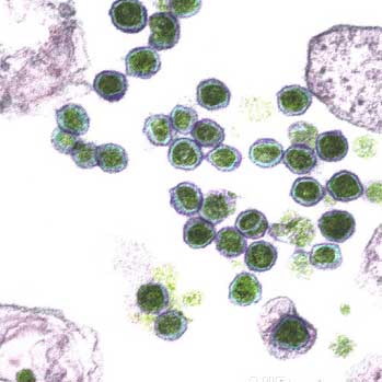 Xenotropic Murine Leukemia Virus (XMRV) - Version 2.0
