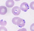 Babesia - Version 1.1