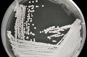 Candida Auris Version 1.0 (superbug)
