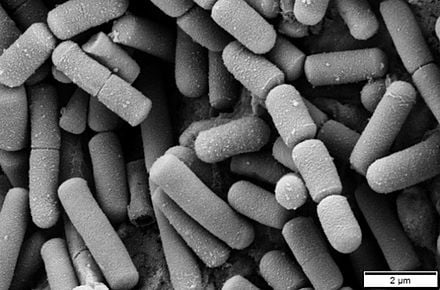 Bacillus Cereus - COVID Cofactor